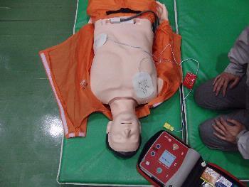 AED電極パッド貼り付けの写真